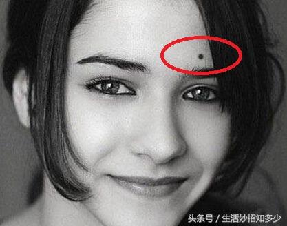 女人哪有痣是最不好的痣(原来女人这五个地方长痣)(2)