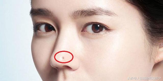 女人哪有痣是最不好的痣(原来女人这五个地方长痣)(4)