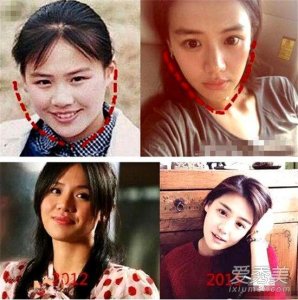 ​马思纯疑似开眼角双眼皮痕迹太明显(马思纯有没有整容)