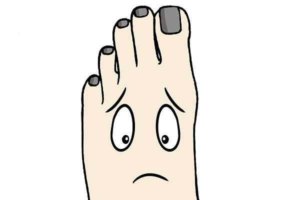 小脚趾甲两瓣的原因(小脚趾指甲分成两瓣对健康的影响)