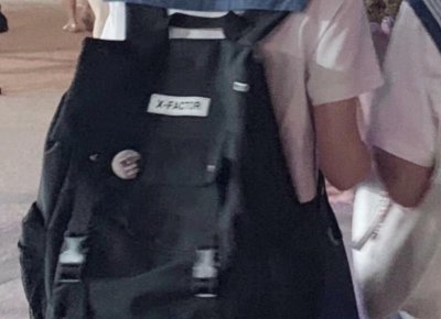 ​王源眼睛被虫子咬了