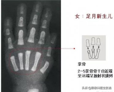 ​孩子骨龄对照表(孩子骨龄对照表孩子六岁耻骨没长出来什么原因)