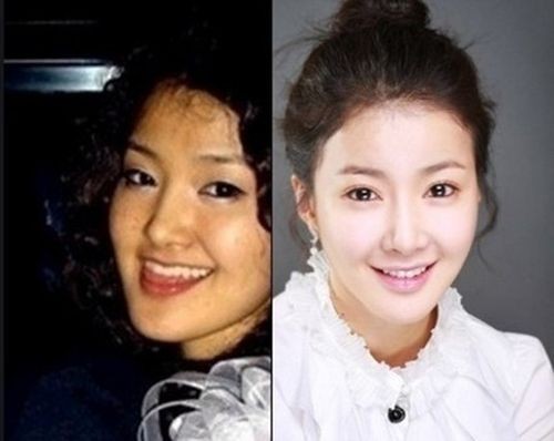 李诗英整容,韩惠珍,本文共(183字) 李诗英整容,韩惠珍,本文共(183字)