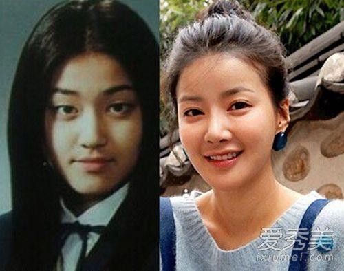 李诗英整容,韩惠珍,本文共(183字) 李诗英整容,韩惠珍,本文共(183字)