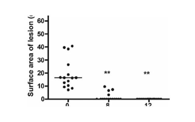 张予曦粉丝，张予曦机场收到粉丝送的10斤陈醋